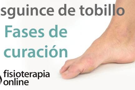 La mejor almohada a la osteocondrosis