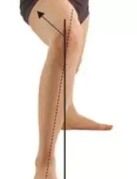 Self-stretch for knees in valgus or knees in X