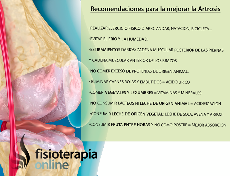 Artrosis o desgaste articular. Qué es, causas, síntomas y tratamiento quirúrgico y de fisioterapia