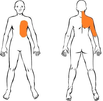 Dolor de espalda alta y cuello lado derecho