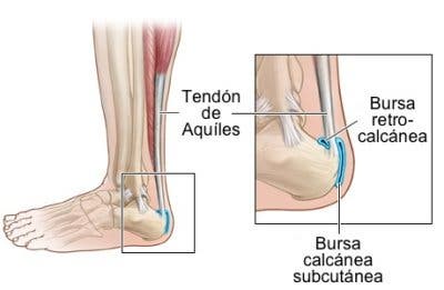 bursa calcanea subcutanea