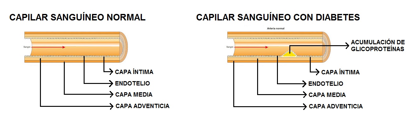 Efecto de la diabetes sobre la circulacion y los capilares