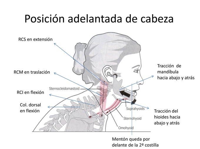 Posición adelantada de cabeza