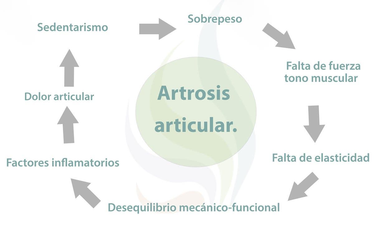 Artrosis o desgaste articular. Qué es, causas, síntomas y tratamiento quirúrgico y de fisioterapia