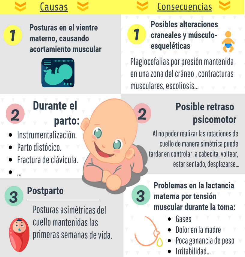 Consecuencias de la tortícolis congénita