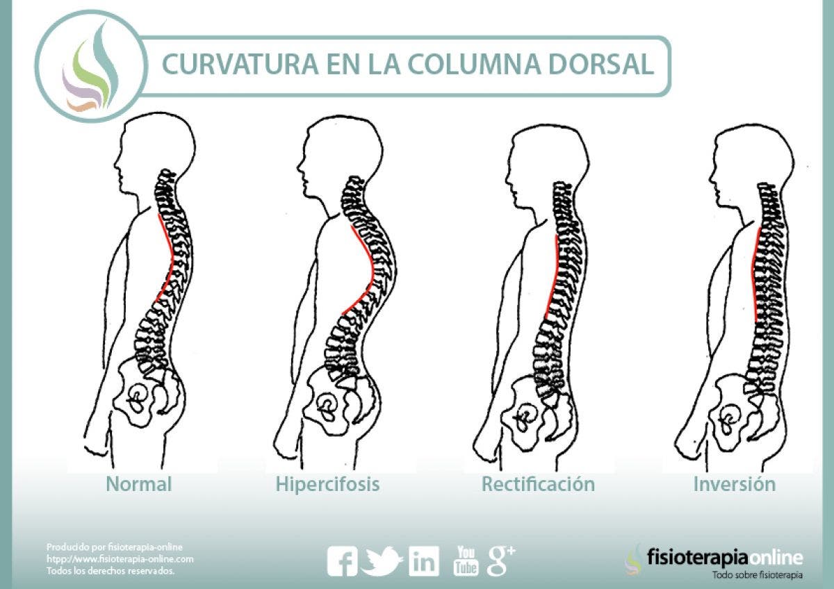 curvaturas en la columna dorsal