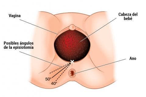 Consejos para cuidar la episiotomía en los primeros días del postparto