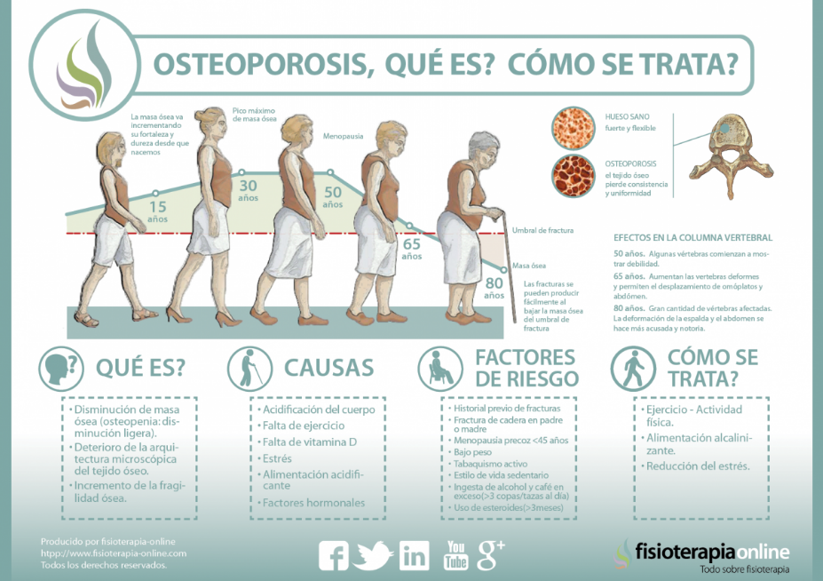 Factores de riesgo de la osteoporosis