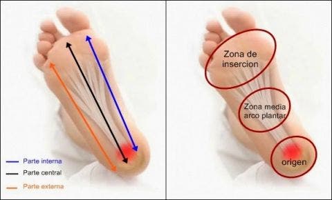 Qu me sucede cuando tengo el pie abierto FisioOnline