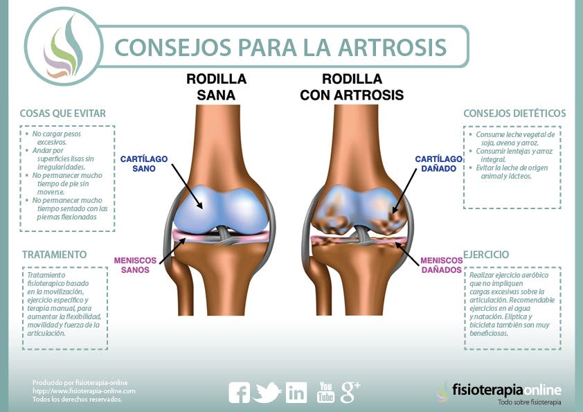 Reumafit: Actividad física y artrosis de rodilla - Inforeuma