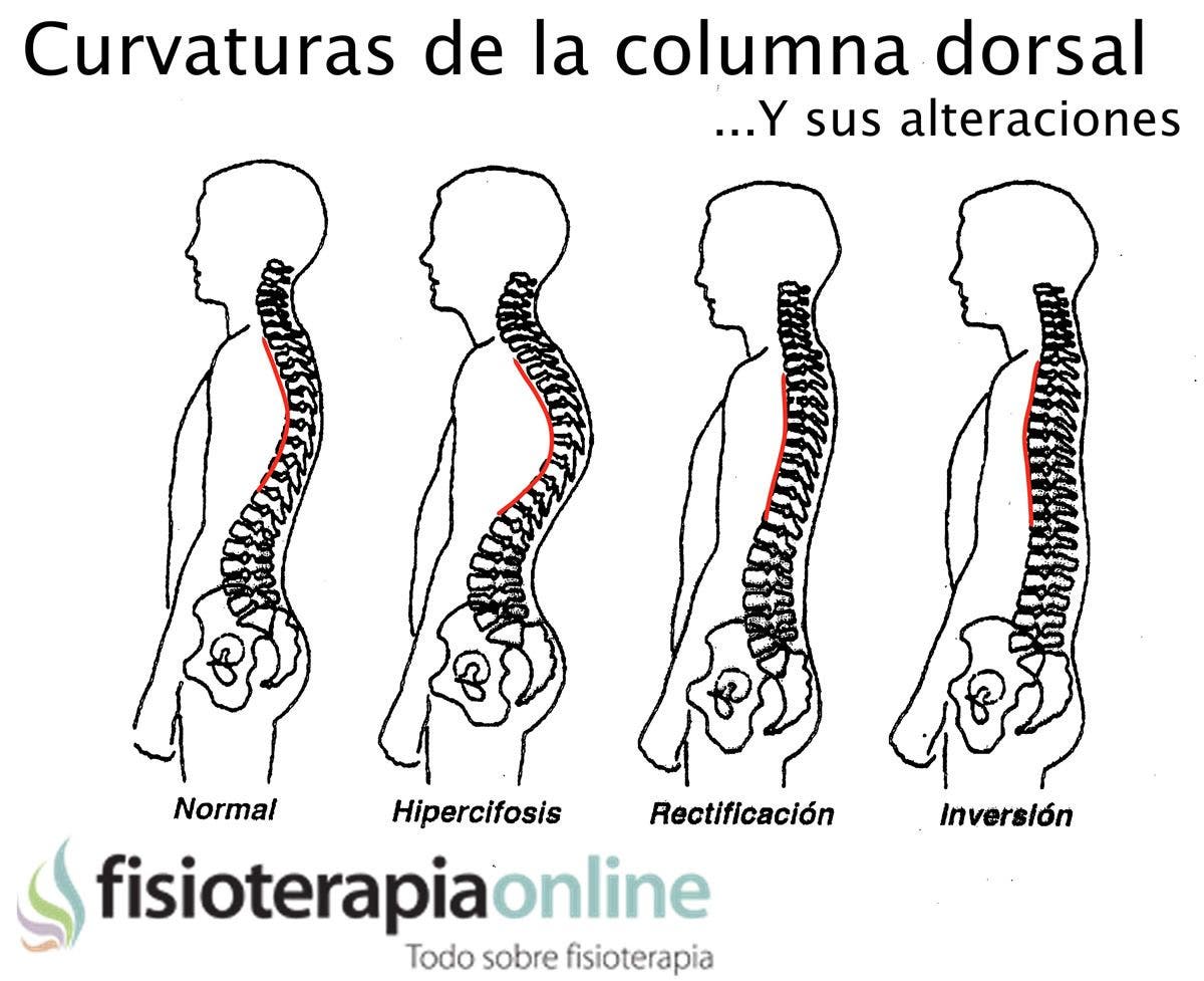 El foro de la operación sobre la columna vertebral la escoliosis