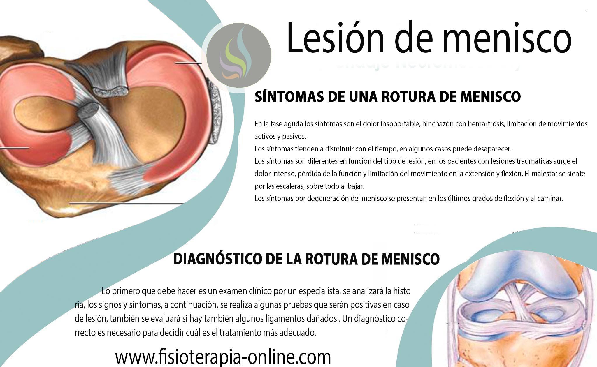 Lesi n y rotura de Menisco Consejos y tratamiento