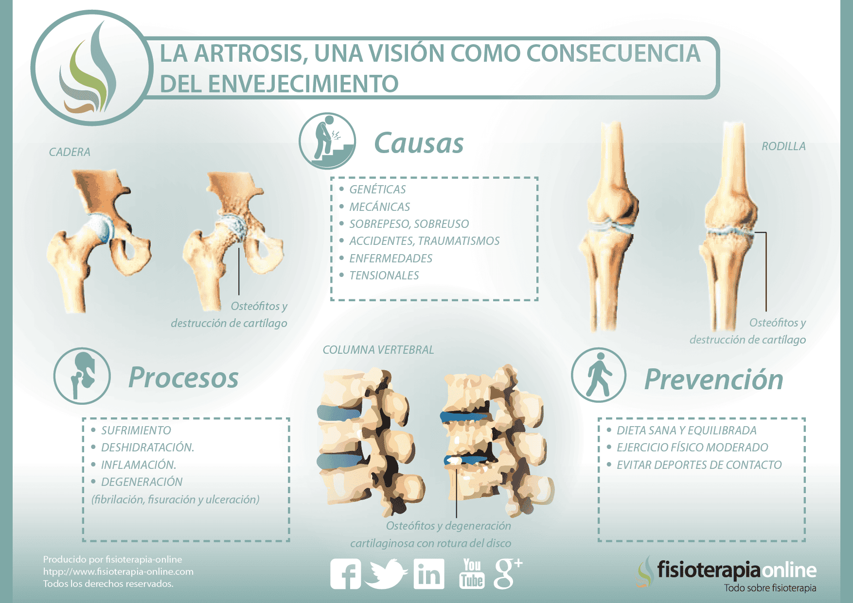 etiologia artrosis de cadera