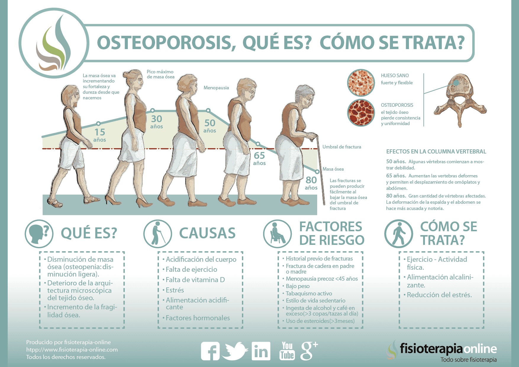 Qué significa la osteopenia