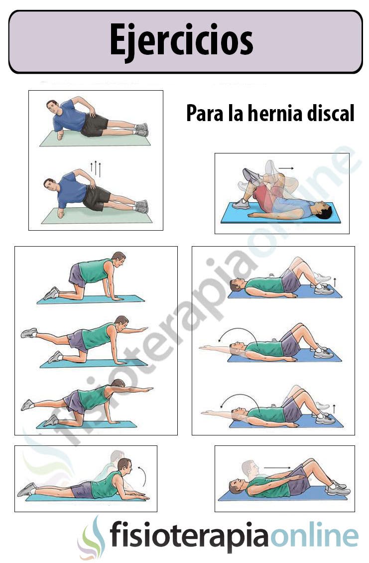 Ejercicios para cuidar tu hernia discal Fisioterapia Online