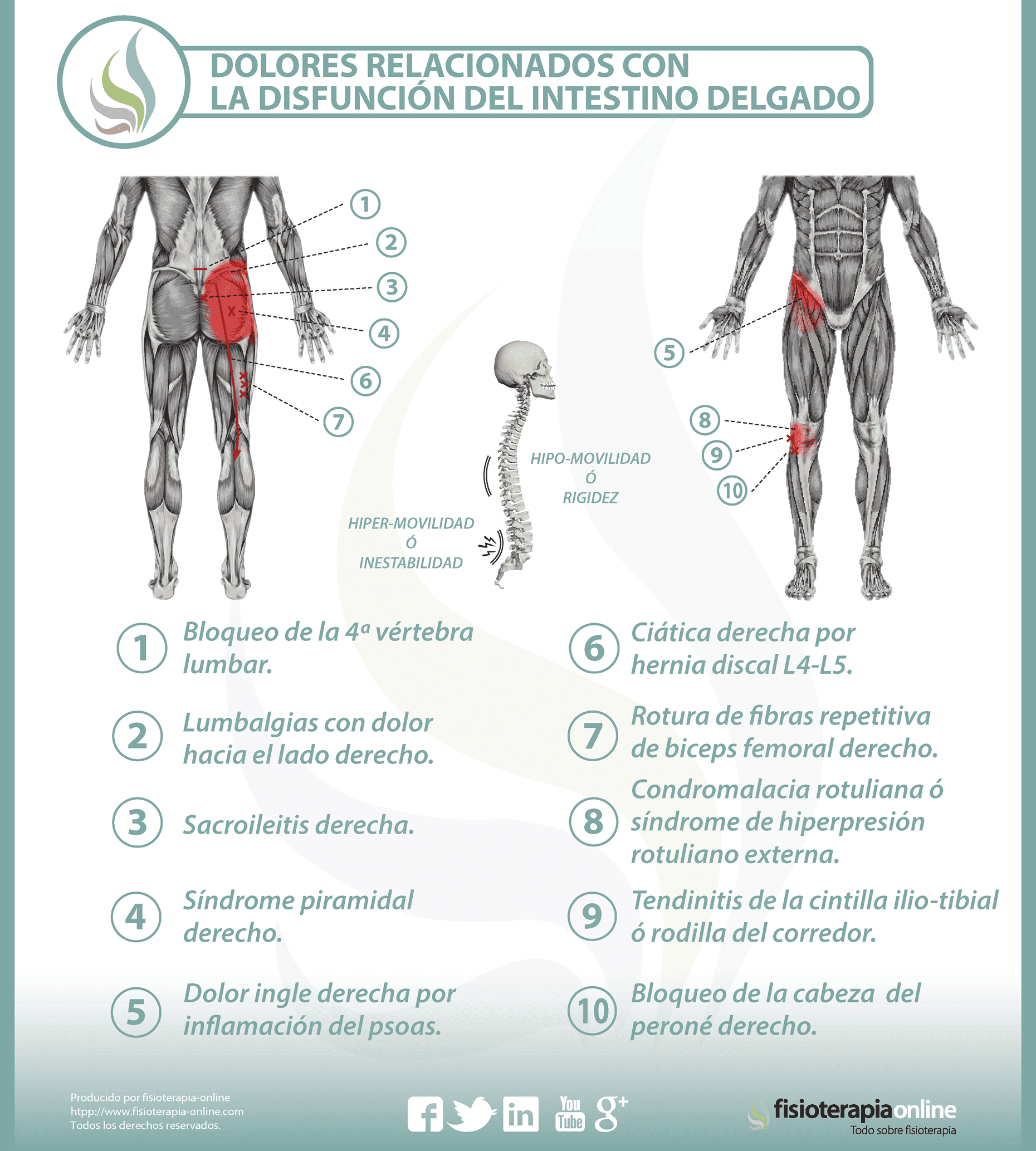 El dolor en epigastrii es dado en la espalda por la pirosis