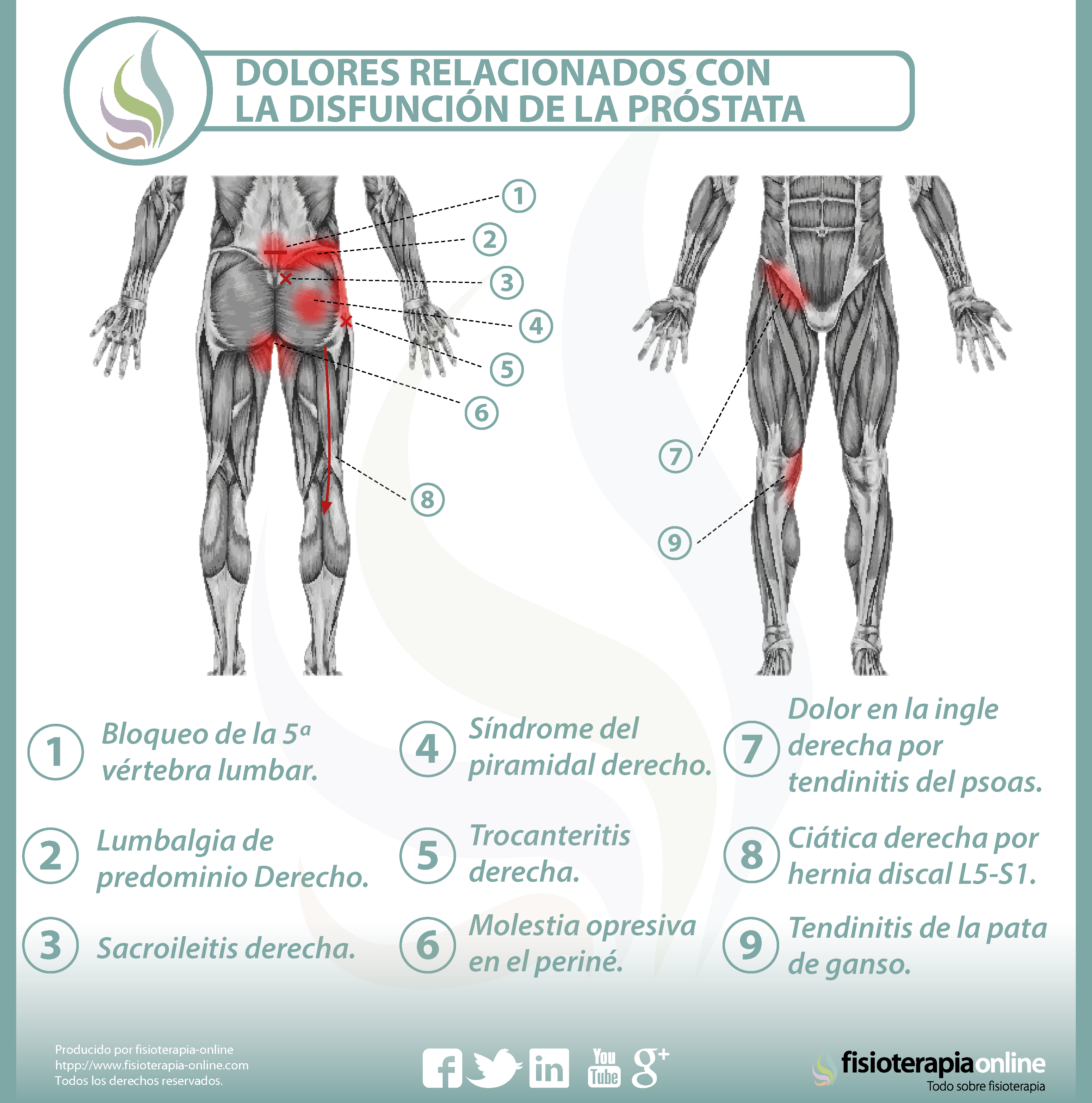 Relación próstata dolor de espalda | FisioOnline