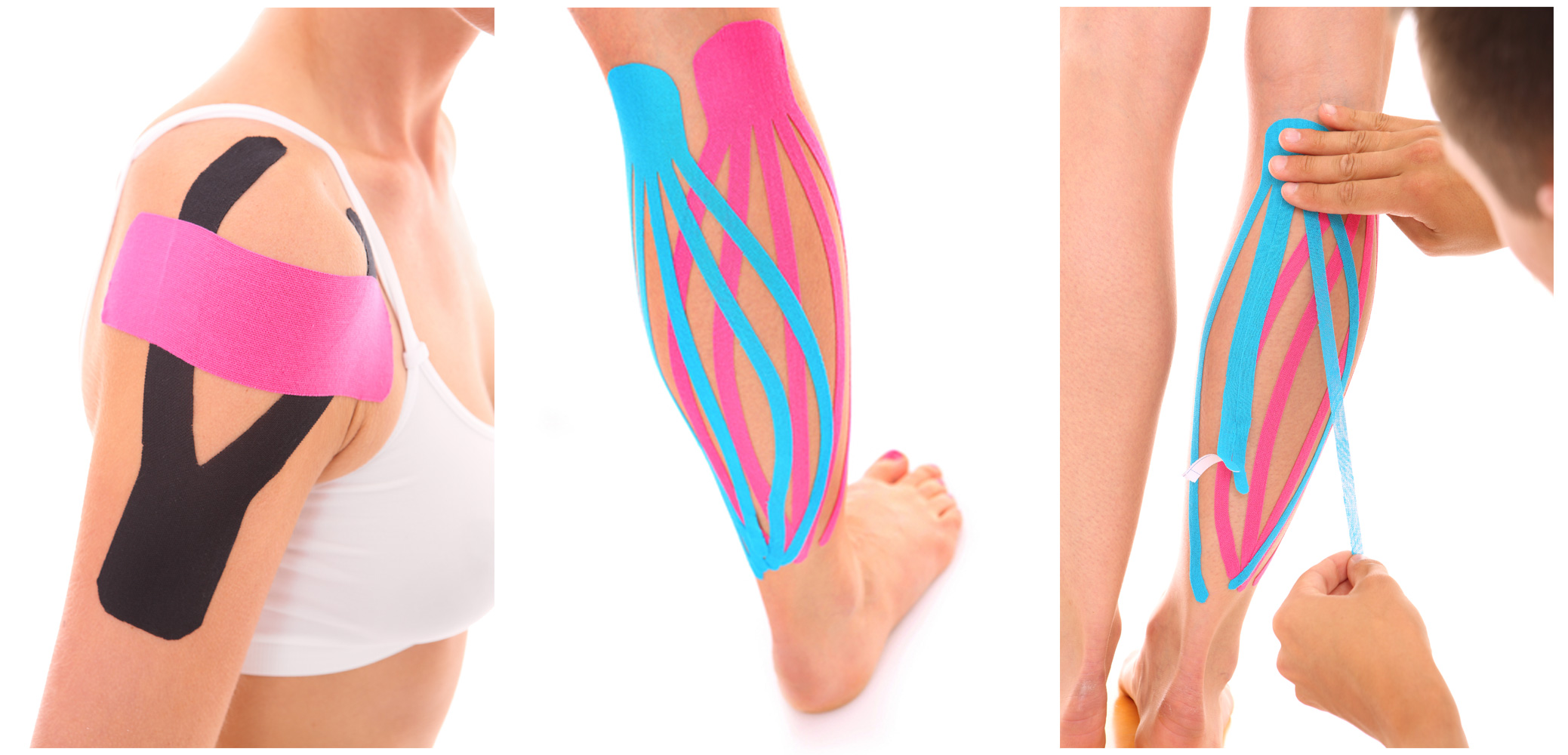 Vendaje neuromuscular - Kinesiotaping