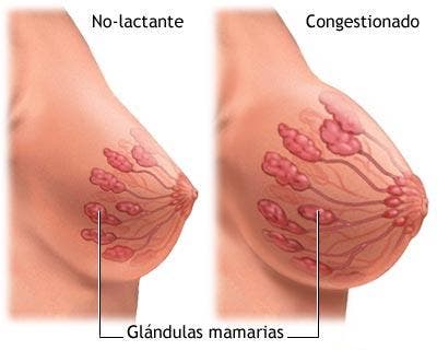 glandulas mamarias