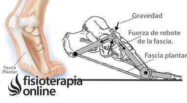 Qué es la Fascitis Plantar Causas Diagnóstico tratamiento