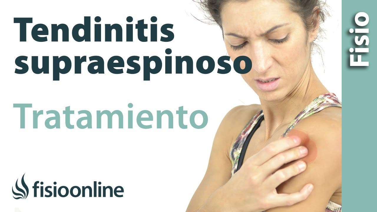 Tratamiento de la tendinitis del supraespinoso con ejercicios
