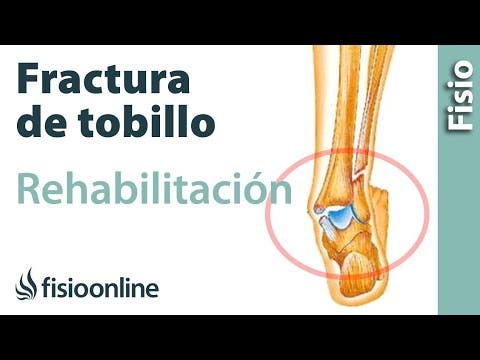 Mago antena teoría Ejercicios, estiramientos y automasajes para rehabilitar una fractura de  tobillo | FisioOnline