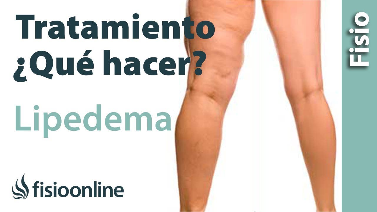 Cirugía de lipedema: muslos y fotos del progreso 