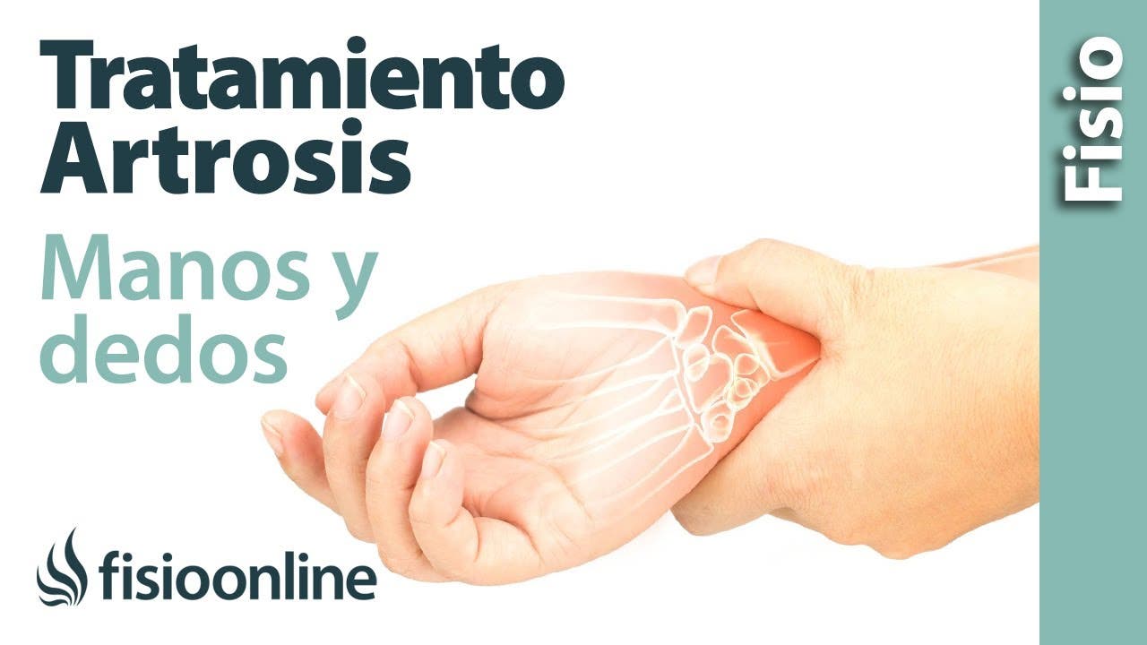 Artrosis de las manos y dedos. Síntomas, Causas, Prevención y Tratamiento