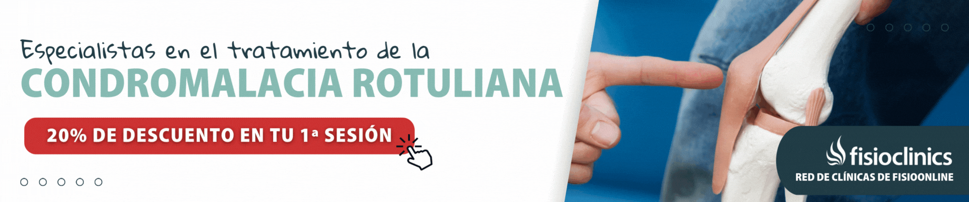 Contacta con nuestros especialitas en el tratamiento de la Condromalacia Rotuliana