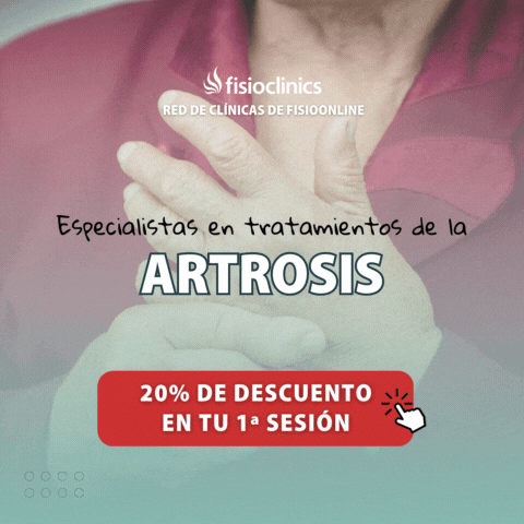 Especialistas en el tratamiento de la Artrosis