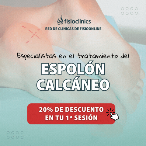 Especialistas en el tratamiento del Espolón Calcáneo