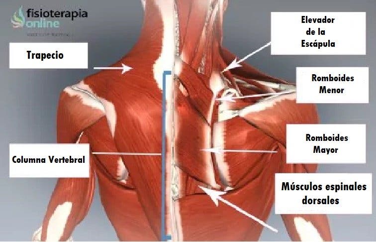 Qué músculos de la espalda se contracturan más