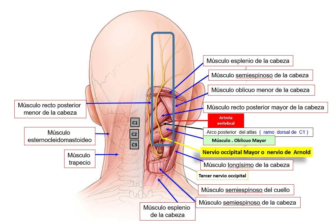 nervios involucrados en la Neuralgia de Arnold