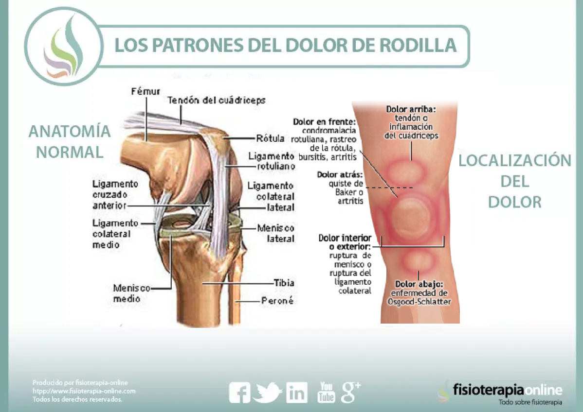 Cuando se inflama la rodilla que puede ser