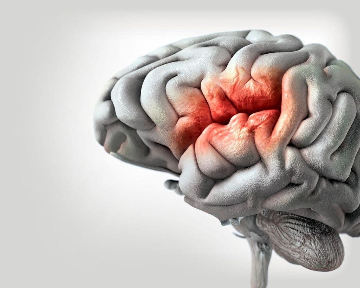 ¿La postura afecta el flujo sanguíneo al cerebro?