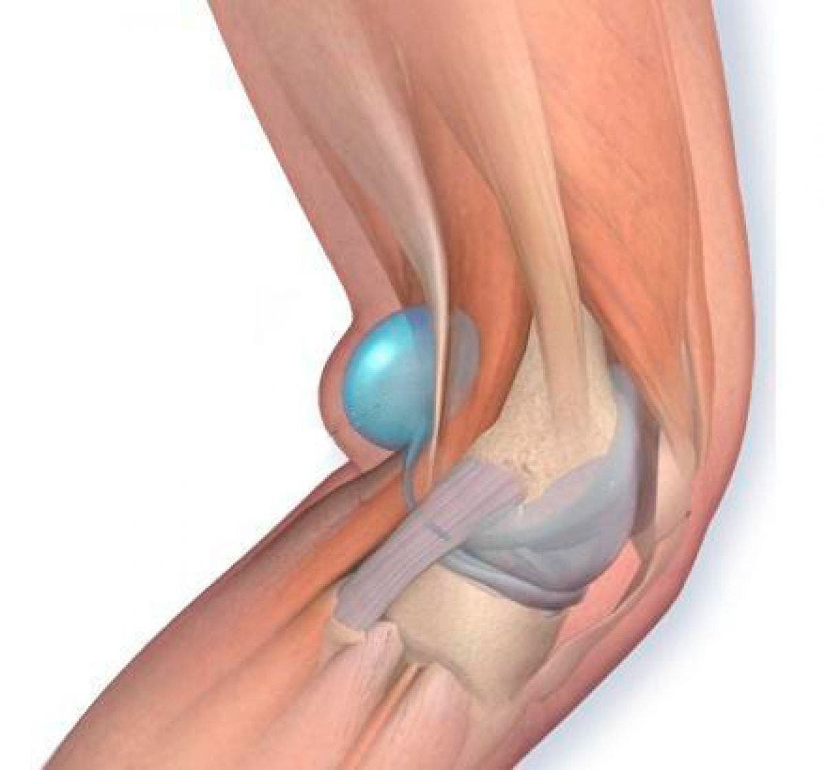 Detrás la izquierda rodilla la por noche de dolor