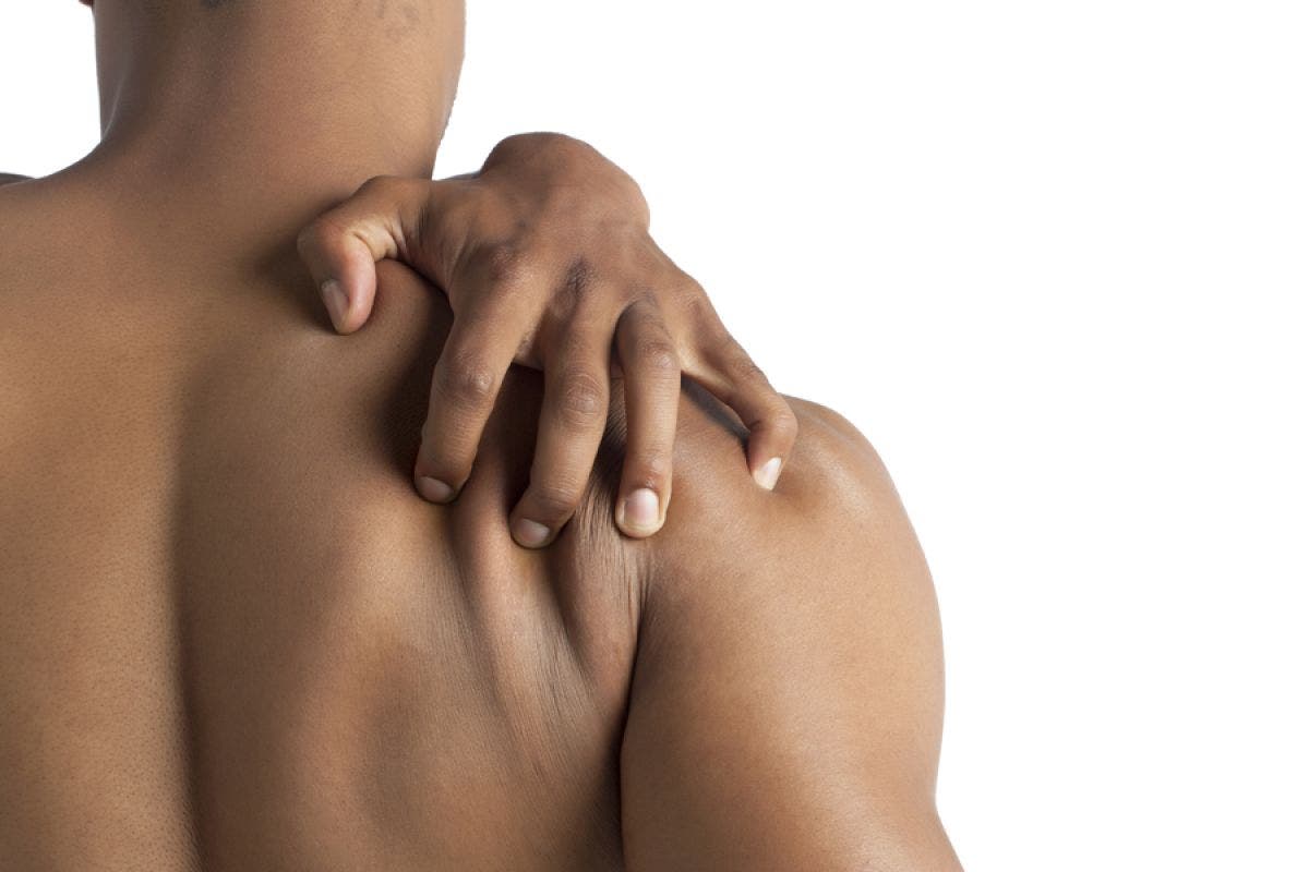 bulto debajo del cuello en la espalda