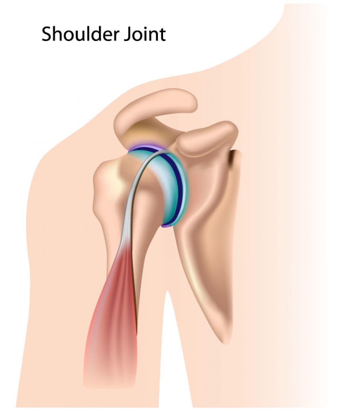 tendinitis biceps braquial tratamiento fisioterapia