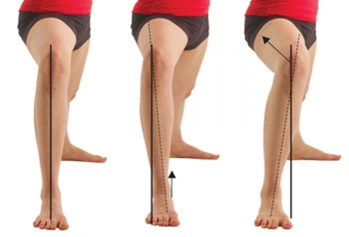 tratamiento fisioterapeutico para inestabilidad de rodilla