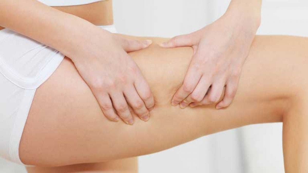 Subcutáneo antebrazo edema