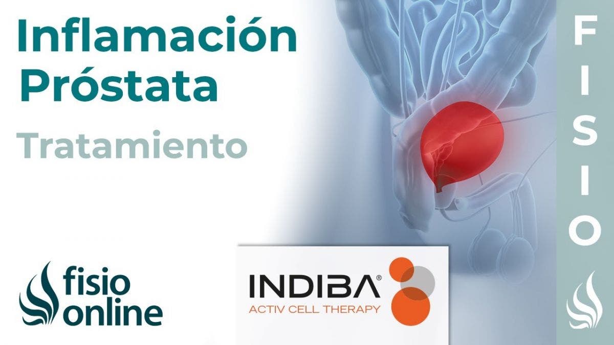 Pautas para el tratamiento de la prostatitis bacteriana crónica Pautas para el tratamiento de la prostatitis bacteriana crónica