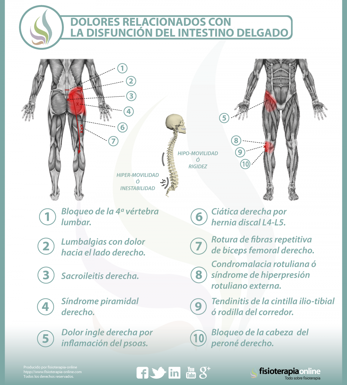 Causas de Hernia discal lumbar entre la L4 y L5 o cuarta y quinta
