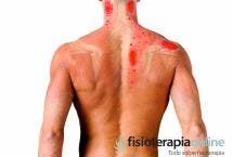 Inflamación y Dolor. ¿Y si fueran necesarios?