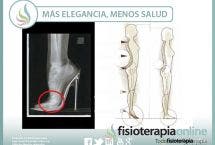 Más elegancia, menos salud. Cuidado con el abuso de los tacones, pueden facilitar problemas de espalda y alterar la correcta postura corporal