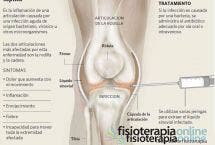 La artritis o inflamación articular, información, consejos y un clarificador vídeo sobre su origen, causas y tratamiento
