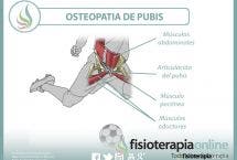 Entendiendo la osteopatía de pubis o pubalgia del futbolista