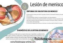 Lesión y rotura de Menisco: Consejos y tratamiento fisioterapéutico