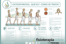 Descubre qué es y cómo se trata la osteoporosis u osteopenia
