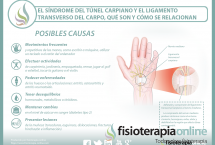 El síndrome del túnel carpiano y el ligamento transverso del carpo, aprende qué son y cómo se relacionan