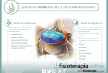 ¿Conoces todo lo necesario acerca de las hernias discales? Te ofrecemos una útil información